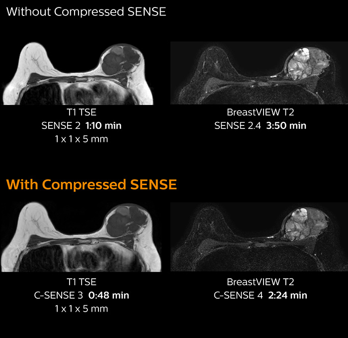 clinical image breast