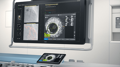 IntraSight video thumbnail image