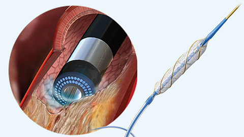 Prepare to succeed in complex PCI