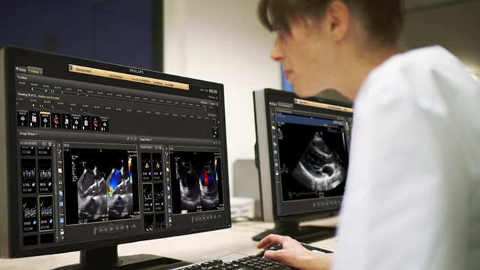 IntelliSpace Cardiovascular
