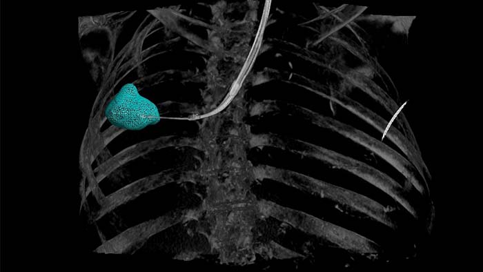 a blue ball in the middle of a chest