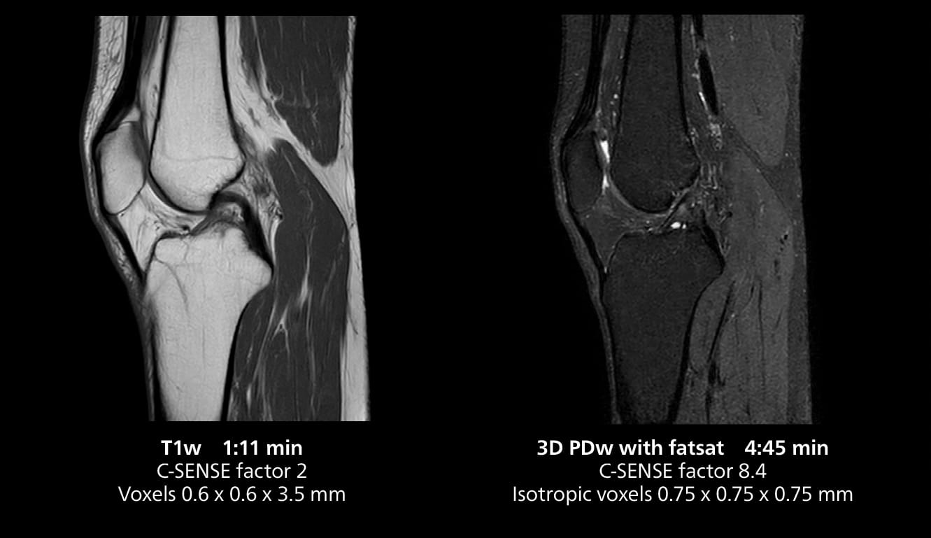 Knee mri one