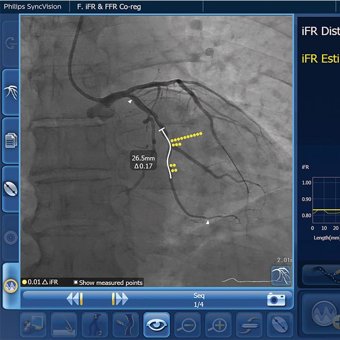 iFR software image