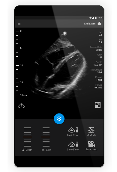 Lumify image